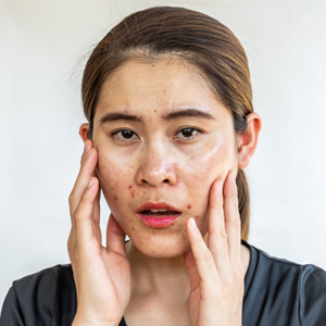 Açúcar e pele | deniseferrandinicosmetics.com