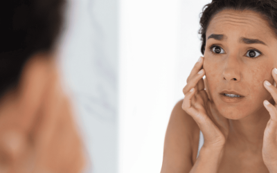 Sugar and Skin: A Silent Connection That Can Accelerate Ageing